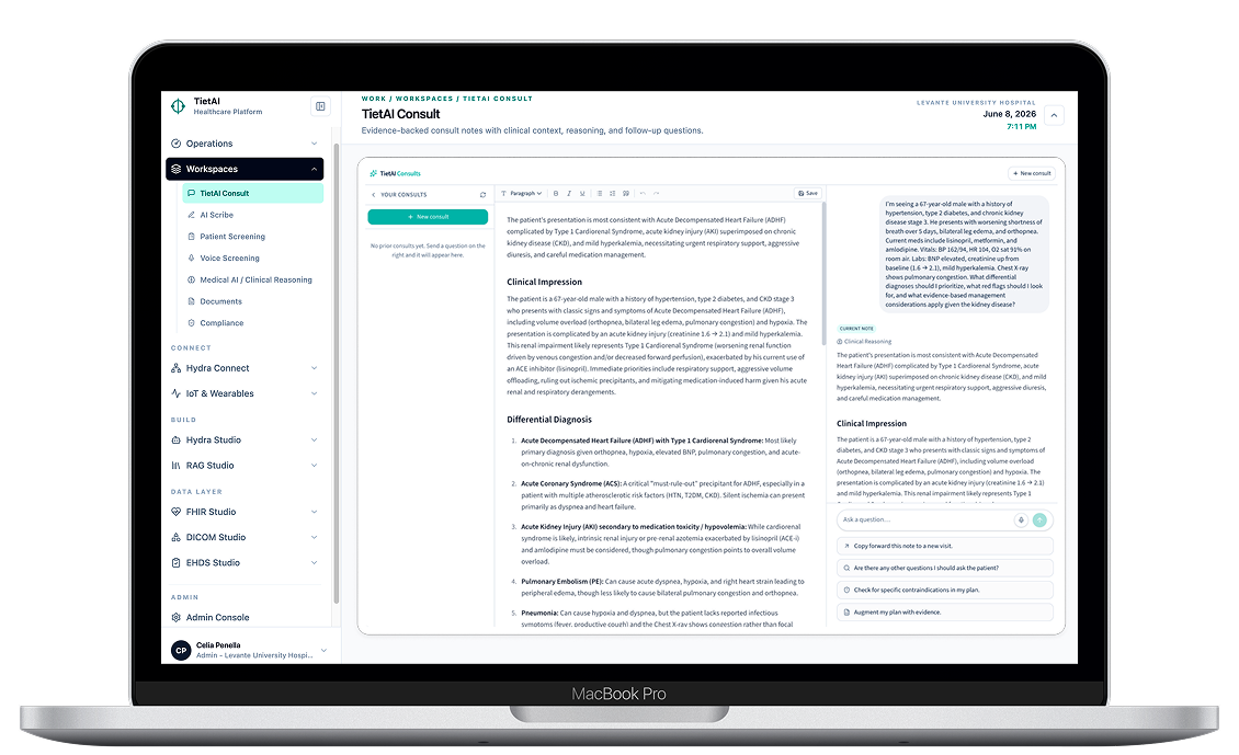 TietAI Consult interface for Vall d'Hebron clinical workflows